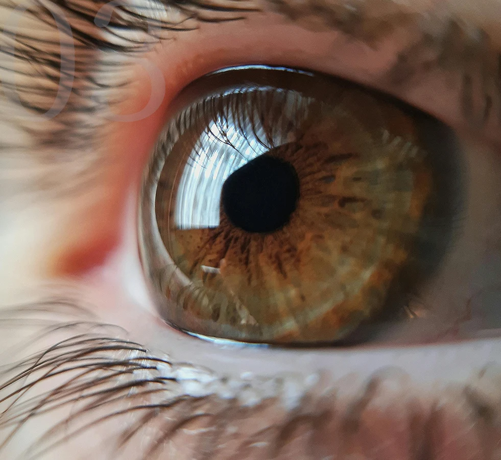 徹底した術前準備と